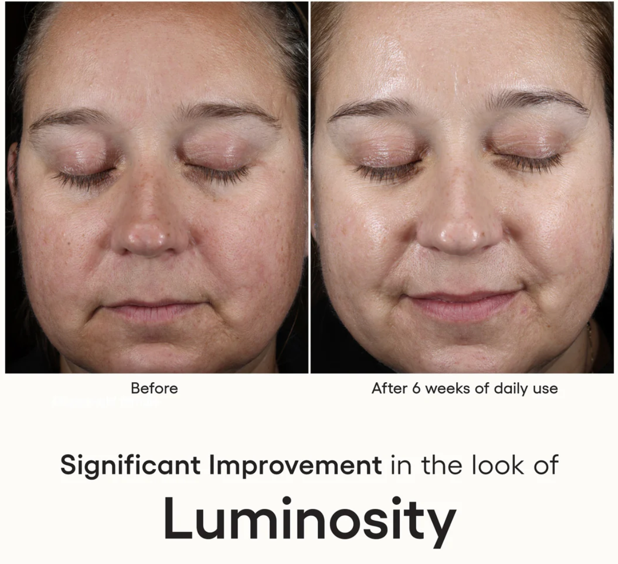 Plated Intense Serum Refill