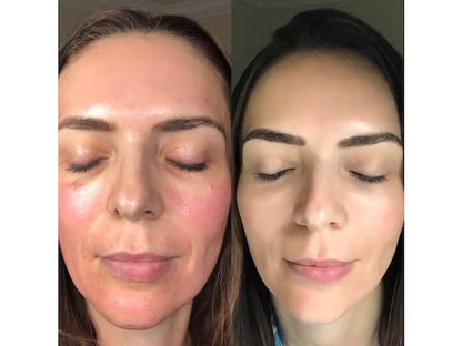 CO2 Lift Pro Carboxy Gel Mask 3 Applications